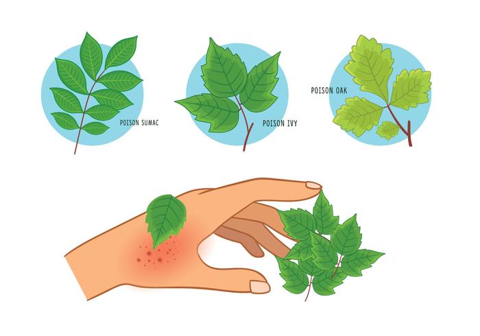 QUICK HEALTH TIPS: Poison Ivy